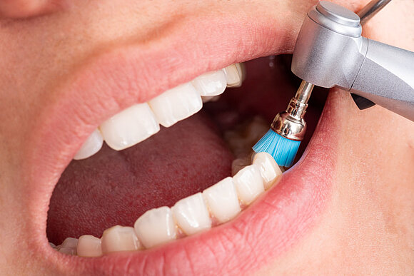 Nahaufnahme eines Hochleistungsinstruments im Einsatz beim Zahnarzt 